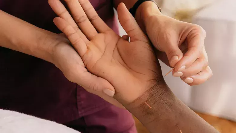 Patient receiving acupuncture on hand